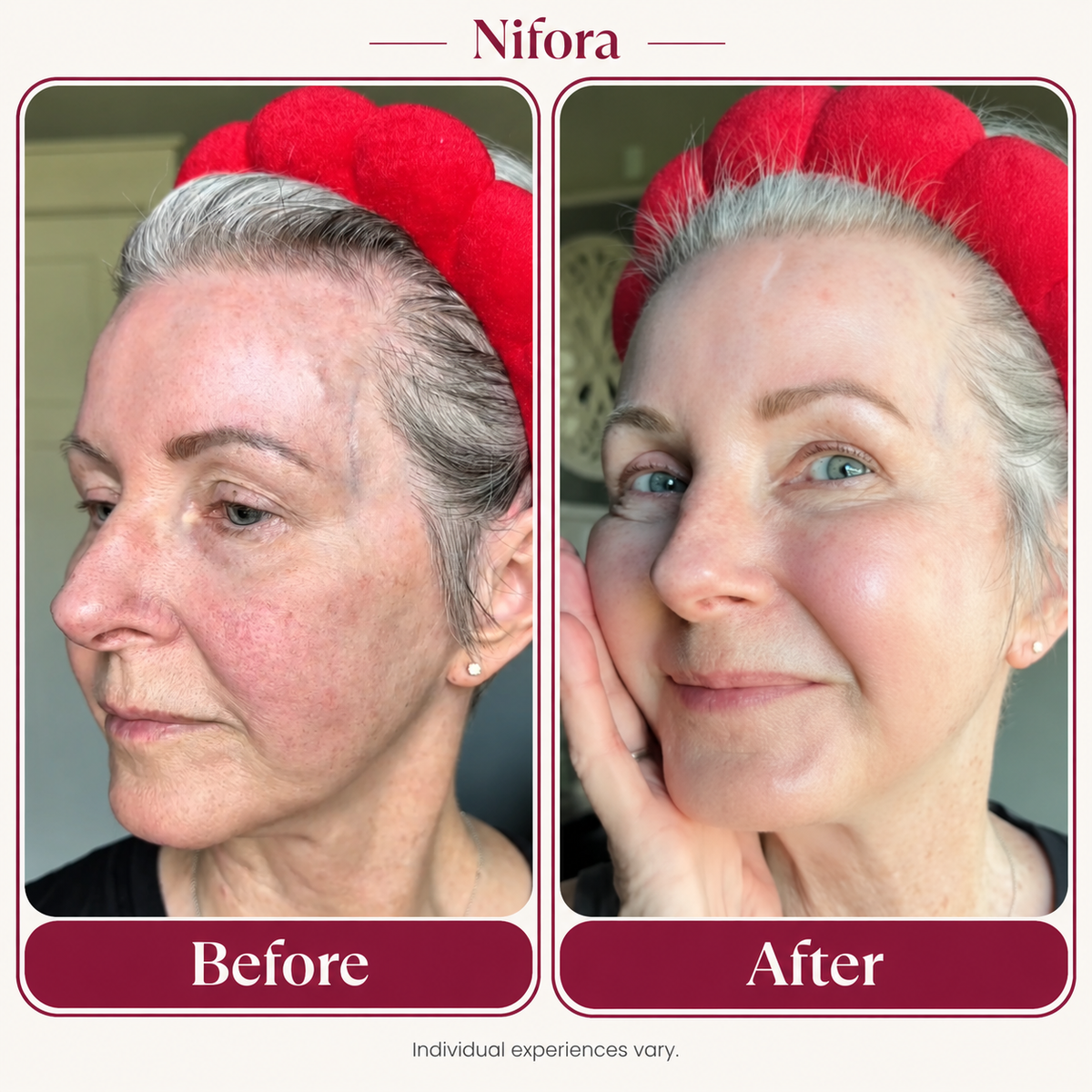 Nifora source customer before-and-after comparison; individual experiences vary